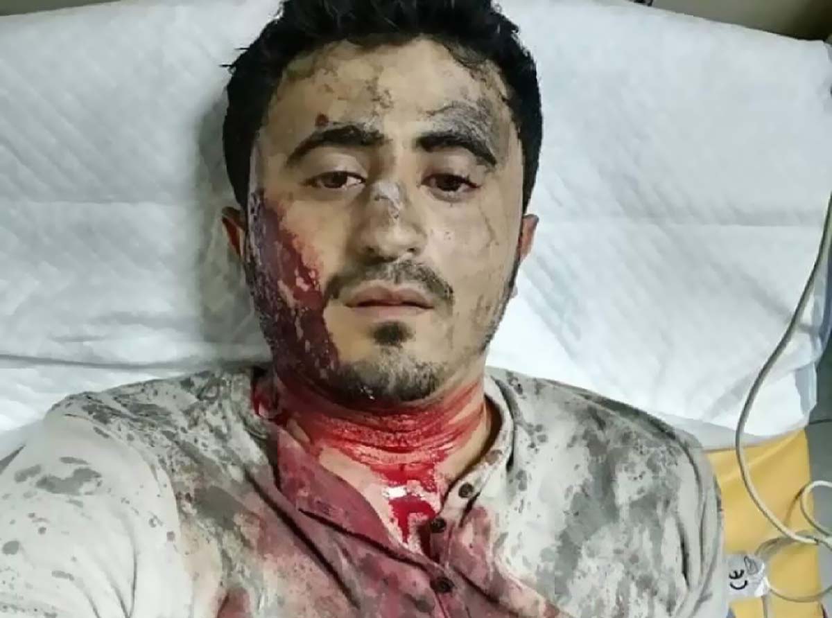 نقابة الصحفيين تدين استهداف مراسل "بلقيس" في حجة والاعتداء على منزل الحداد في صنعاء