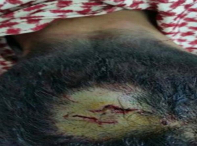 مجهول يعتدي على سكرتير "أخبار اليوم" ونقابة الصحفيين تدين الاعتداء على "العليي والعامري"